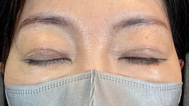 Postoperative Condition Part 1