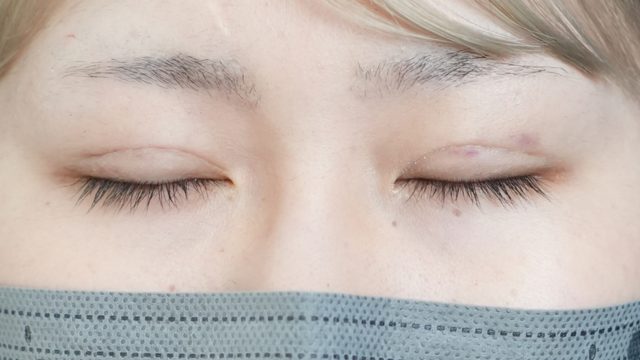 Postoperative Condition Part 1