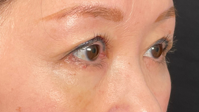 Postoperative Condition Part 1