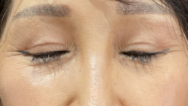 Postoperative Condition Part 1