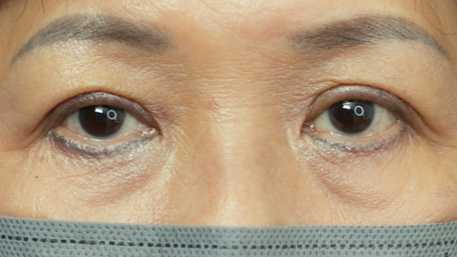 Postoperative Condition Part 1