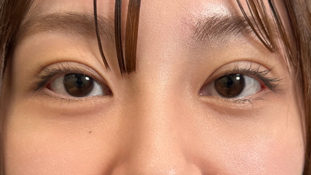 Postoperative Condition Part 1