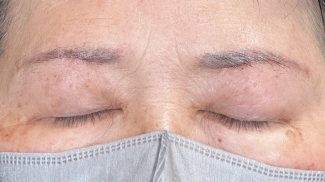 Postoperative Condition Part 1