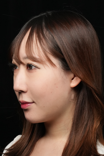 Postoperative Condition Part 1