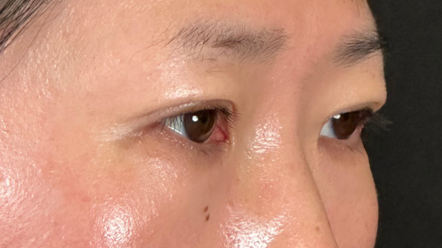 Postoperative Condition Part 1