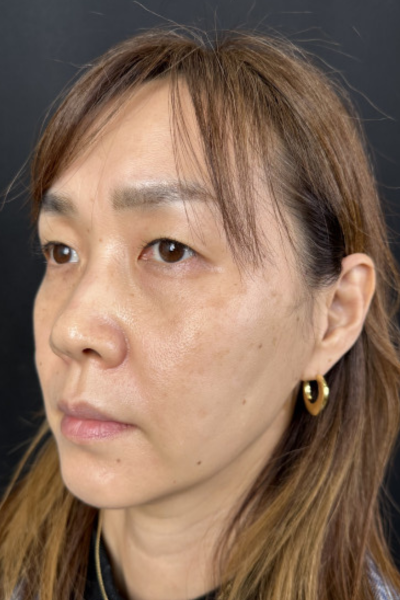 手術前の状態 その1