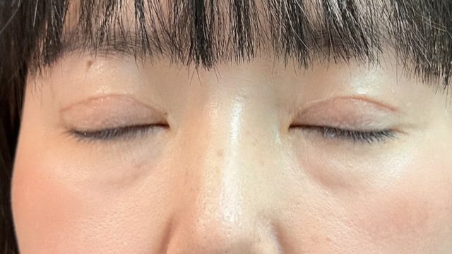 Postoperative Condition Part 1