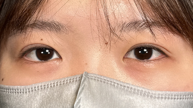 Postoperative Condition Part 1