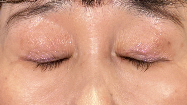 Postoperative Condition Part 1