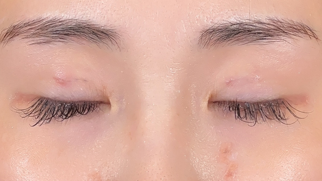 Postoperative Condition Part 1