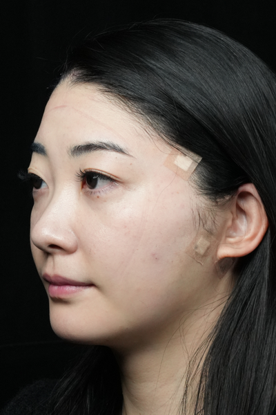 手術前の状態 その1