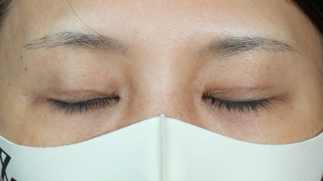 Postoperative Condition Part 1