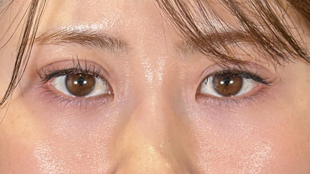 Postoperative Condition Part 1