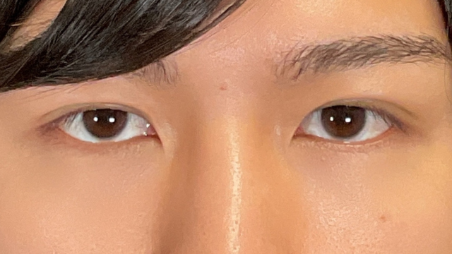 Postoperative Condition Part 1