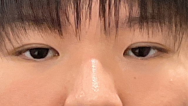 Postoperative Condition Part 1