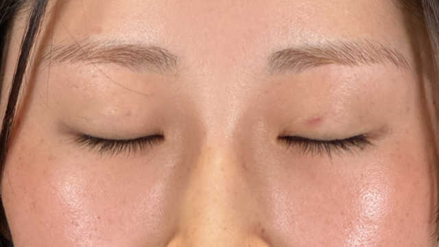 Postoperative Condition Part 1