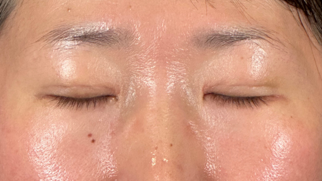 Postoperative Condition Part 1