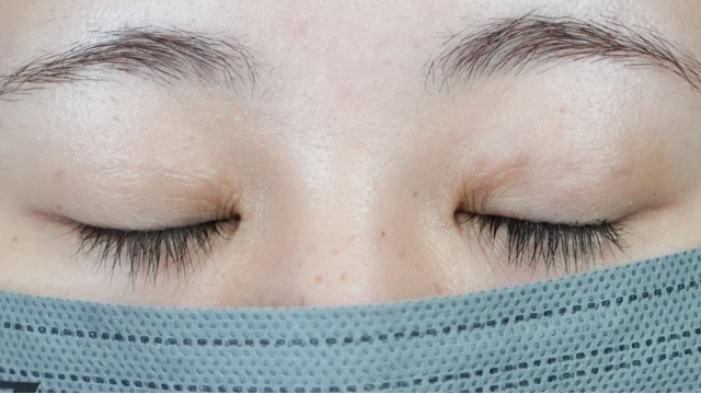 Postoperative Condition Part 1