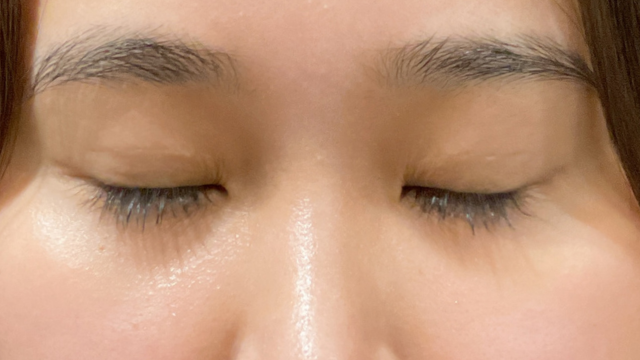 Postoperative Condition Part 1