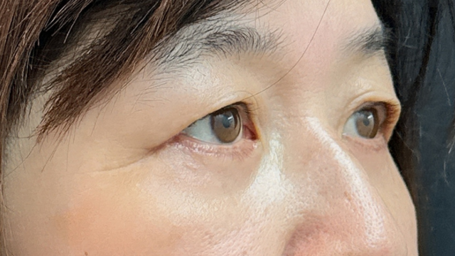 Postoperative Condition Part 1