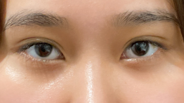 Postoperative Condition Part 1