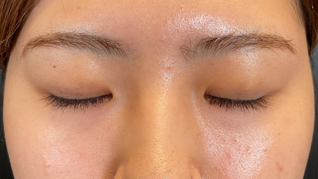 Postoperative Condition Part 1