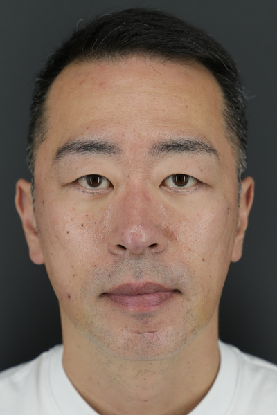 Postoperative Condition Part 1