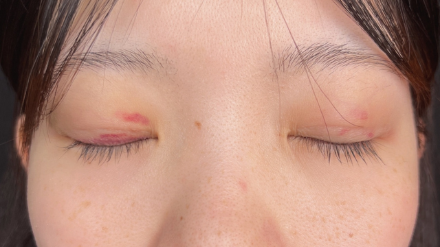 Postoperative Condition Part 1