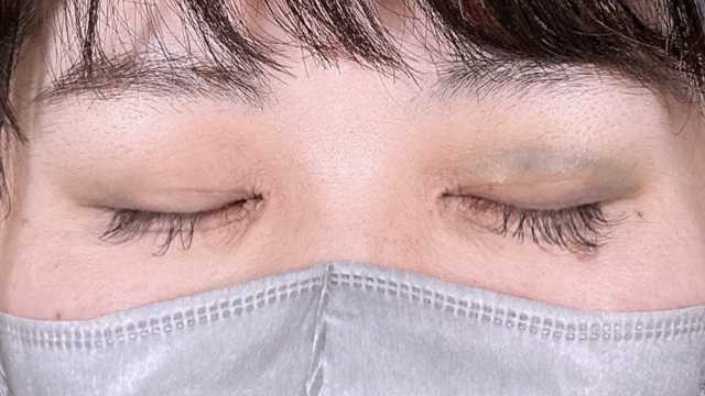 Postoperative Condition Part 1