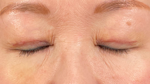 Postoperative Condition Part 1