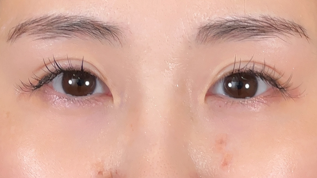 Postoperative Condition Part 1