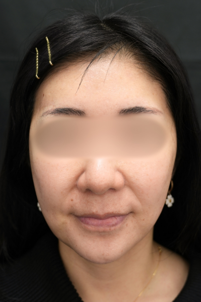 Postoperative Condition Part 1