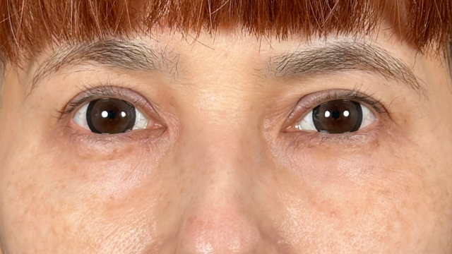 Postoperative Condition Part 1