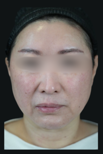 手術前の状態 その1