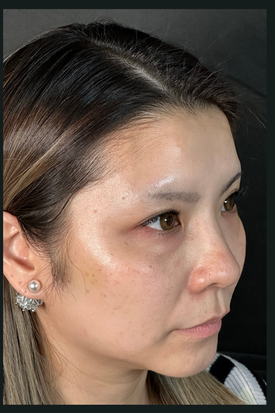 手術前の状態 その1