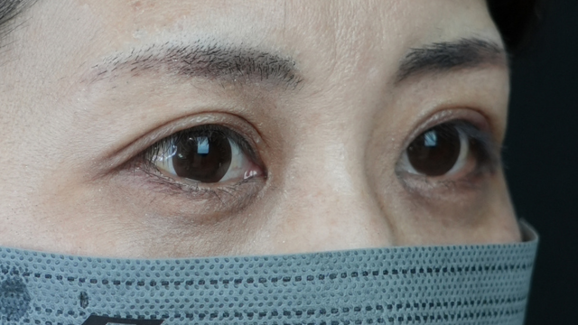 Postoperative Condition Part 1