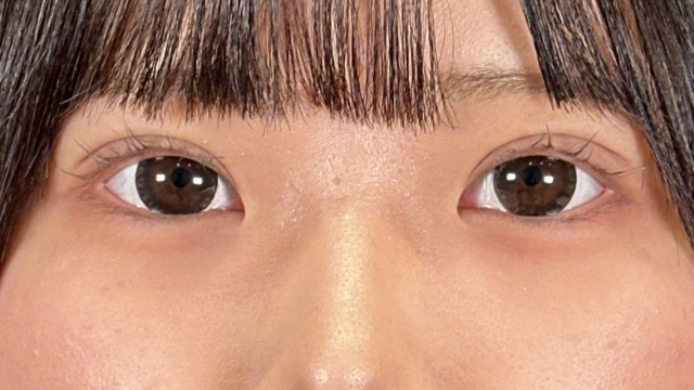 Postoperative Condition Part 1