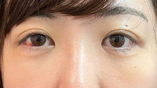 Postoperative Condition Part 1