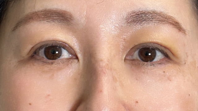 Postoperative Condition Part 1