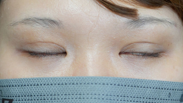 Postoperative Condition Part 1