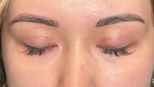 Postoperative Condition Part 1