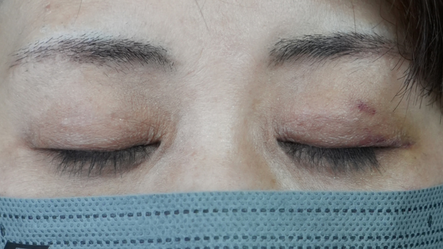 Postoperative Condition Part 1