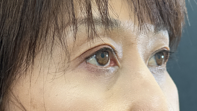 Postoperative Condition Part 1