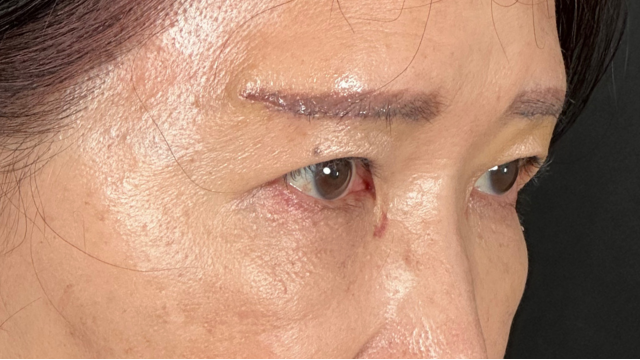 Postoperative Condition Part 1