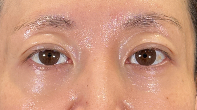 Postoperative Condition Part 1