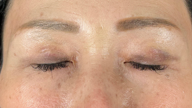 Postoperative Condition Part 1