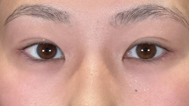 Postoperative Condition Part 1