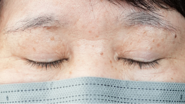 Postoperative Condition Part 1