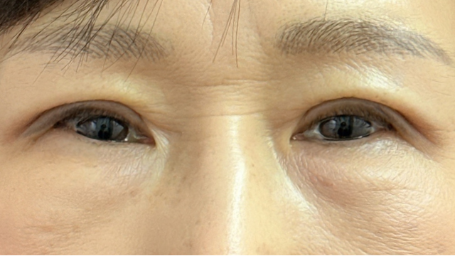 Postoperative Condition Part 1