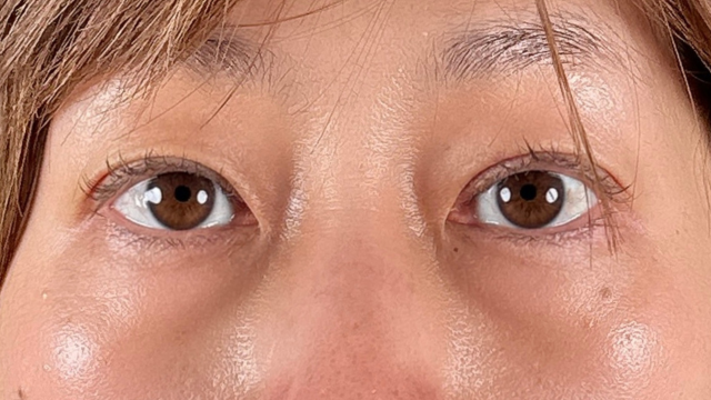 Postoperative Condition Part 1